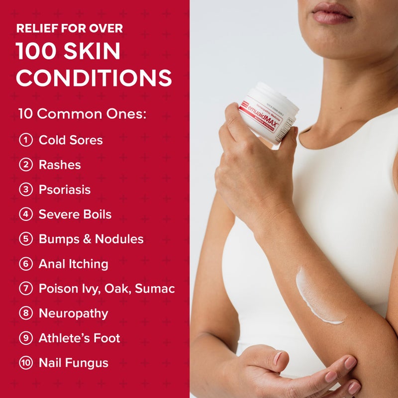 emuaid EMUAIDMAX Ointment for Itchy Skin, Maximum Strength Treatment for Athlete's Foot, Psoriasis, Jock Itch, Rash, Eczema, Cold Sores, Blisters, and Yeast Infection 2oz - Image 5